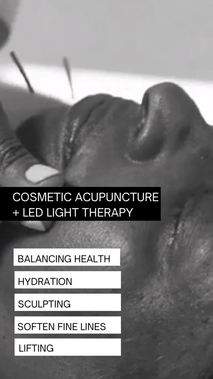 We use natural, ancient traditions to rejuvenate aging skin - through Cosmetic Acupuncture + LED light therapy.
✨We plump, lift, sculpt, hydrate, improve circulation, and build collagen to soften lines
✨But the focus is really on you as a whole and your skin is only one part of the equation
✨We want to harmonise your internal health so we can rejuvenate your skin… From the inside out
✨Focus on your overall health and wellbeing - digestion, sleep, energy, stress, hormones using body acupuncture points.
✔️Accept and feel confident in your own skin
✔️Embrace the aging process and love the skin you are in
Because glowing skin comes from within.
Follow for more insights on the power of Chinese Medicine for not only enhancing your skin but your overall wellbeing
—————
Cosmetic Acupuncture & LED light therapy available at Glow Acupuncture & Chinese Medicine 106 Canterbury Rd Middle Park VIC 3206
#cosmeticacupuncture #facialacupuncture #faceyogaexercises #guashatools #skinfromwithin #acupuncture #chinesemedicine #skintipsandtricks #faceacupuncture #skincareadvice #holisticbeauty #agingskin #naturalskincare