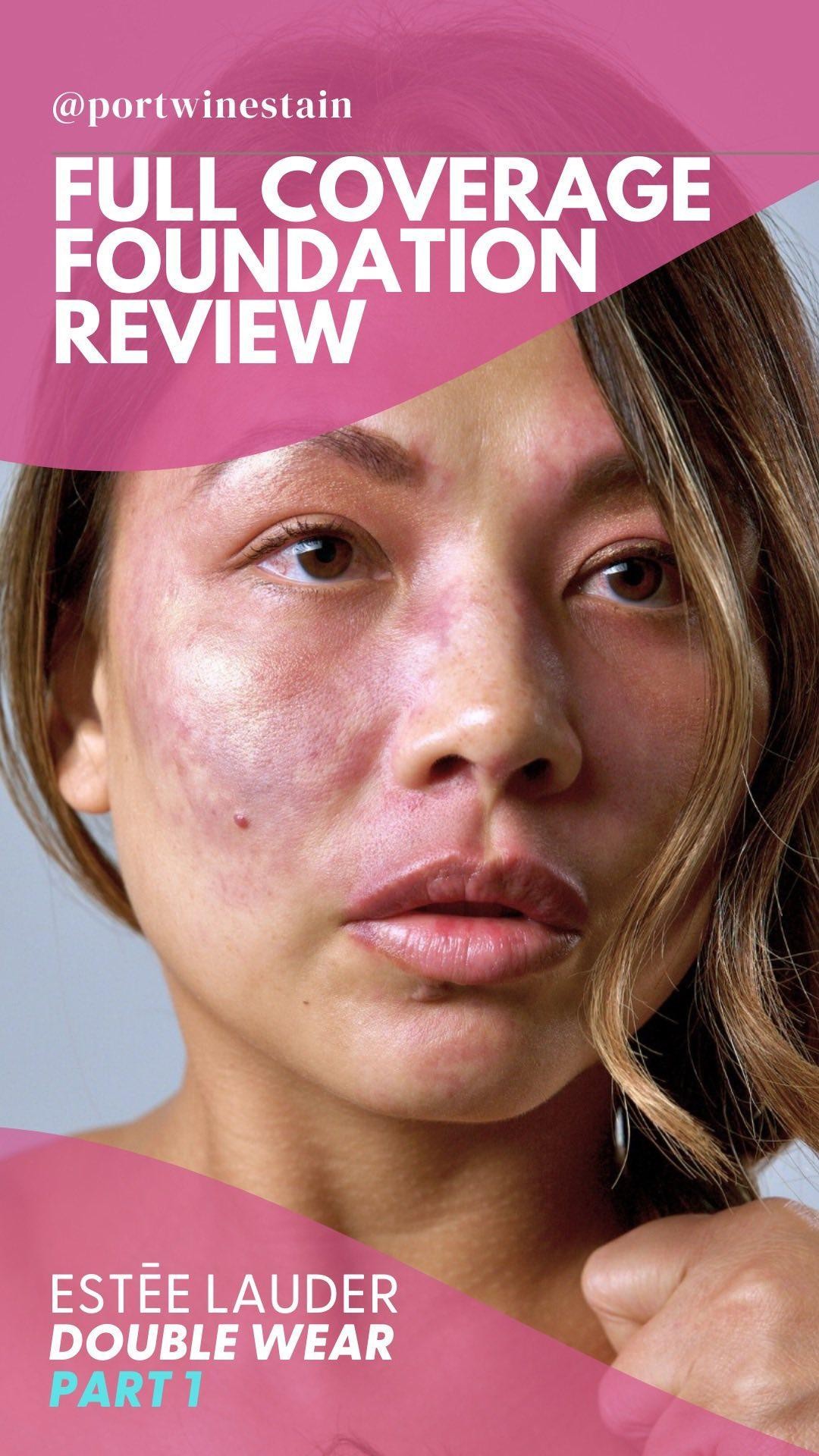 Curious about the Estée Lauder Double Wear Foundation? Watch the full review here Estee Lauder Foundation: All-Day Coverage Test with Birthmark
https://youtu.be/Ek8WYwLjMFs