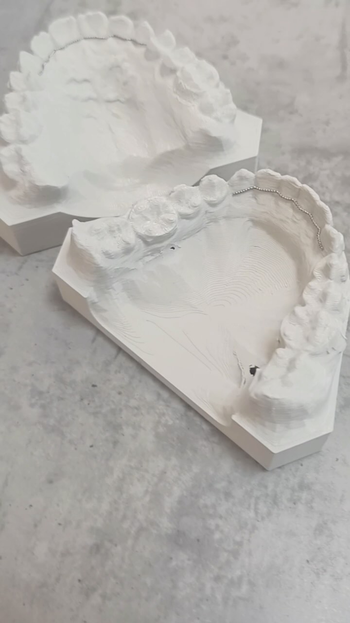 Mit dem Retainer-Robo jetzt innerhalb weniger Minuten den perfekt passenden Draht anfertigen 🤩✌️
#kfo #retainer #docklinker #hildesheim