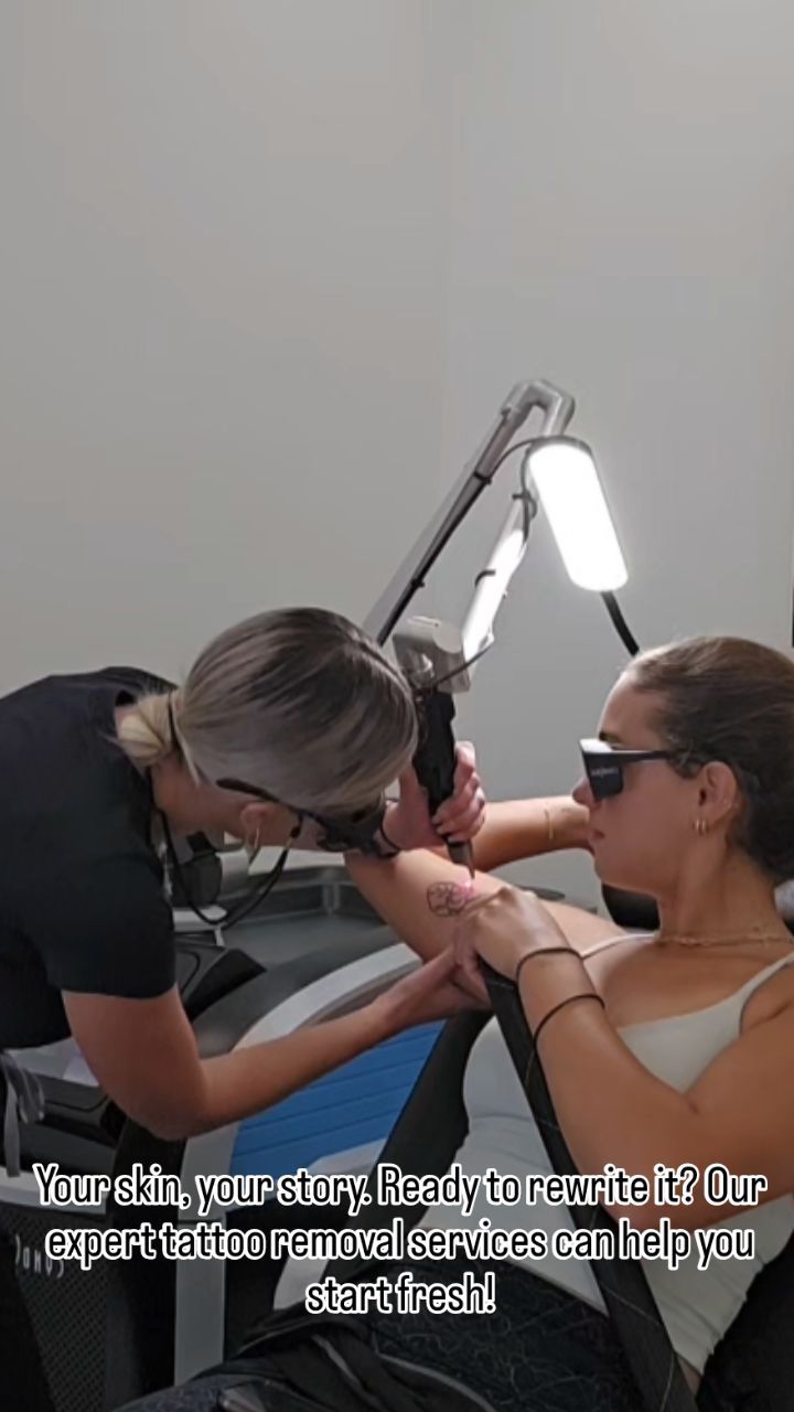 ✨️Thinking about tattoo removal? Book your consultation today and let’s create a custom plan for your clear skin goals ! ✨️
#cynosure #windsor #tattoremoval #picosure #picosurelaser #montell_beauty #clearskin #beauty #permenantmakeupremoval #detroit