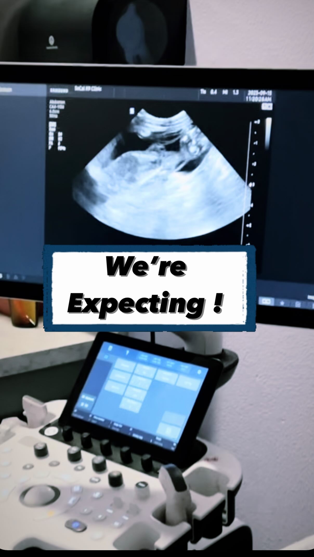 We have exciting news !!!!
We couldn’t be more excited to welcome two new litters to the West Coast Goldendoodles family.
Gigi and Cali are both expecting and puppies should arrive the second week of October. As the due date approaches, we will be eagerly awaiting the arrival of these precious puppies. We will keep you updated on their progress and share photos of their adorable faces once they are born.
Gigi’s waitlist is currently full. Additional spots may open once puppies arrive.
We have limited availability remaining on Cali’s litter
• Expected weight 20 - 40 LBS
• Intense red and white abstract
• Wavy and curly coats expected
If you are interested in adding a furry friend to your family, please send me a message or comment below, and I will send you a link to begin our application process.
Thank you for sharing in our excitement as we anticipate the arrival of these little miracles. Stay tuned for additional updates and plenty of adorable puppy photos and videos 🐾🐾
How many puppies do you think each mama will have?
Let me know in the comments ⬇️
.
.
.
.
.
.
.
.
#goldendoodle #goldendoodlepuppies #newbornpuppies #ultrasound #dogultrasound #expectingpuppies #minigoldendoodles