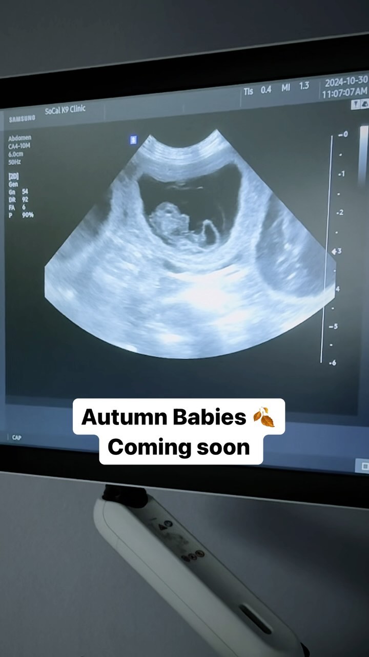 We are over the moon waiting for Cali’s babies to arrive
We are having a repeat litter of mini goldendoodles. with Cali and Boots! Their last litter was so gorgeous.
Anticipated due date is November 27th.
This Thanksgiving, we’ll be extra grateful for all the new little paws and wagging tails coming into our lives. Our holiday will be filled with plenty of extra love, joy… and, of course, a little sleep deprived.
Stay tuned for updates as we prepare to welcome our fluffy bundles of joy! 🐾
We are currently accepting applications for our last remaining spot on our waitlist.
• Expected weight – 25 to 35 pounds
• Wavy and curly coats
• Red, red with white abstract markings, red and white parti
.
.
.
.
.
.
#goldendoodlepuppies #puppy #puppies #ultrasound #puppiesofinstagram #thanksgivingpuppies