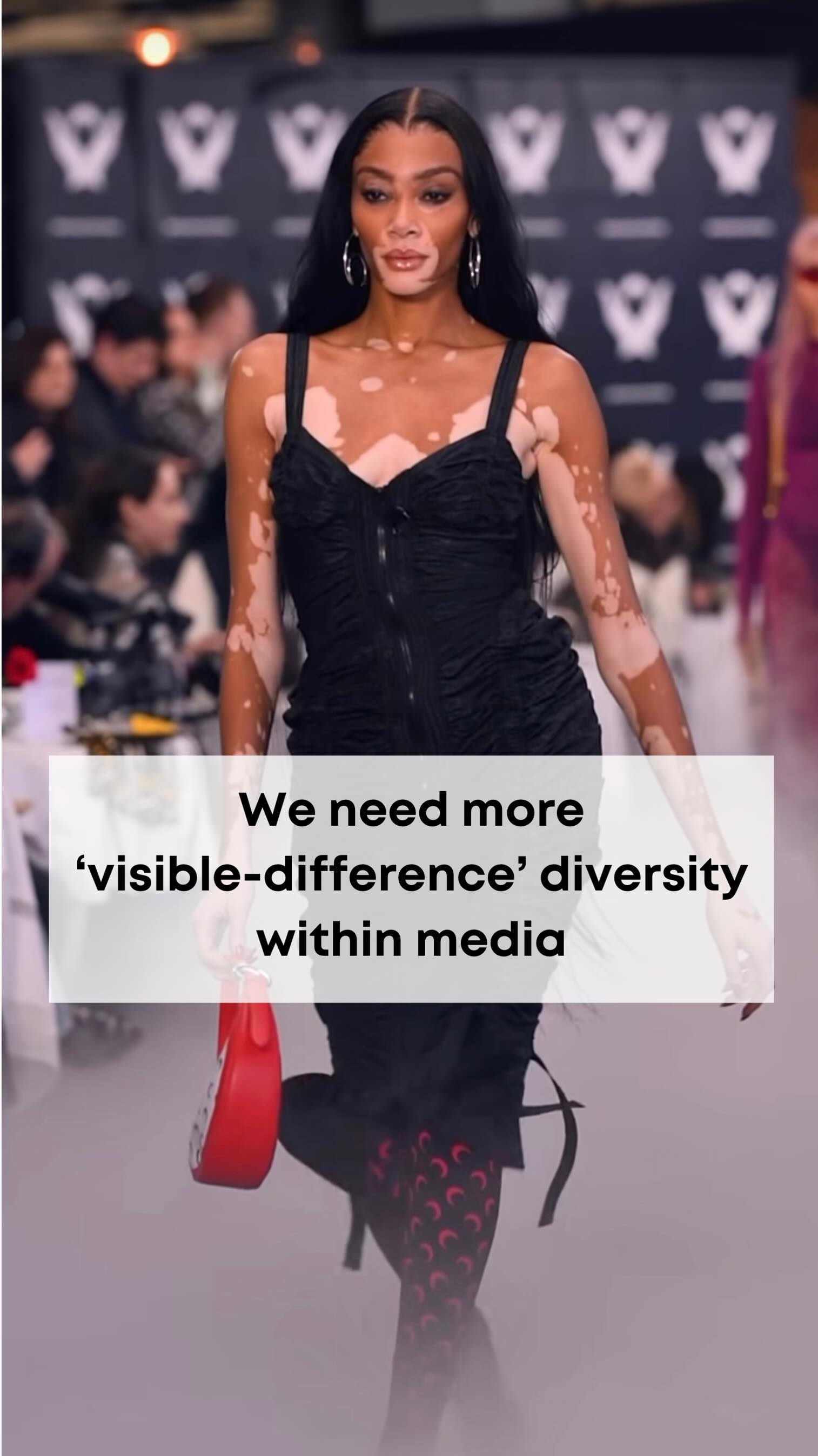 It’s been wonderful to see the strides made in diversity when it comes to body size, shape, color, and even skin conditions within mainstream media over the last few years. BUT, I think there’s still a whole lot more strides to be made here.
Let’s see more growth in this area!🗣️ What do ya’ll think…what are your thoughts/feelings on this topic?
**w/ me is our birthmark bro @manymoreminimonsters 🥰💞
.
.
.
.
.
.
.
.
.
.
.
.
#visibledifference #diversity #mainstreammedia #birthmarks #scars #keloids #psoriasis #eczema #tv #movies #commercials #cartoons #magazines #media #news #community