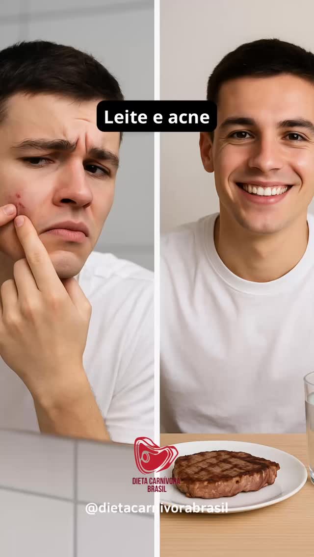 A verdade: leite e derivados inflamam. Pele bonita começa na dieta! ✨
📲 Para mais dicas, siga @dietacarnivorabrasil e consulte a nutricionista Tania Alves do @nutridados para um acompanhamento personalizado! 👩⚕️🥩
#SemLaticínios #AcneNuncaMais #PeleBonita #Carnívoro