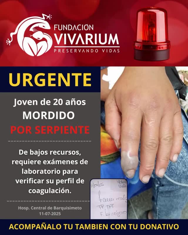 🆘 Ayuda urgente para joven mordido por mapanare en Barquisimeto
Un joven de bajos recursos fue mordido en el dedo por una serpiente mapanare. Actualmente presenta edema severo, cambio de coloración preocupante y riesgo de necrosis.
Se encuentra hospitalizado y necesita apoyo urgente para exámenes, tratamiento y posibles dosis adicionales de suero antiofídico.
Desde Fundación Vivarium lo estamos acompañando con orientación médica, apoyo logístico y seguimiento. Tu donación puede hacer la diferencia.
Dona, comparte, salva una vida.
💚 Tu ayuda puede marcar la diferencia.
💚 Acompáñalo tú también con tu donativo.
📲 Pago Móvil: Bancamiga J-502156399 / 0424-408.5311
#AccidenteOfídico #FundaciónVivarium #SueroAntiofídico #Emergencia #SaludVenezuela #DonarSalvaVidas #Barquisimeto #envenenamientoofidico #ayudahumanitaria