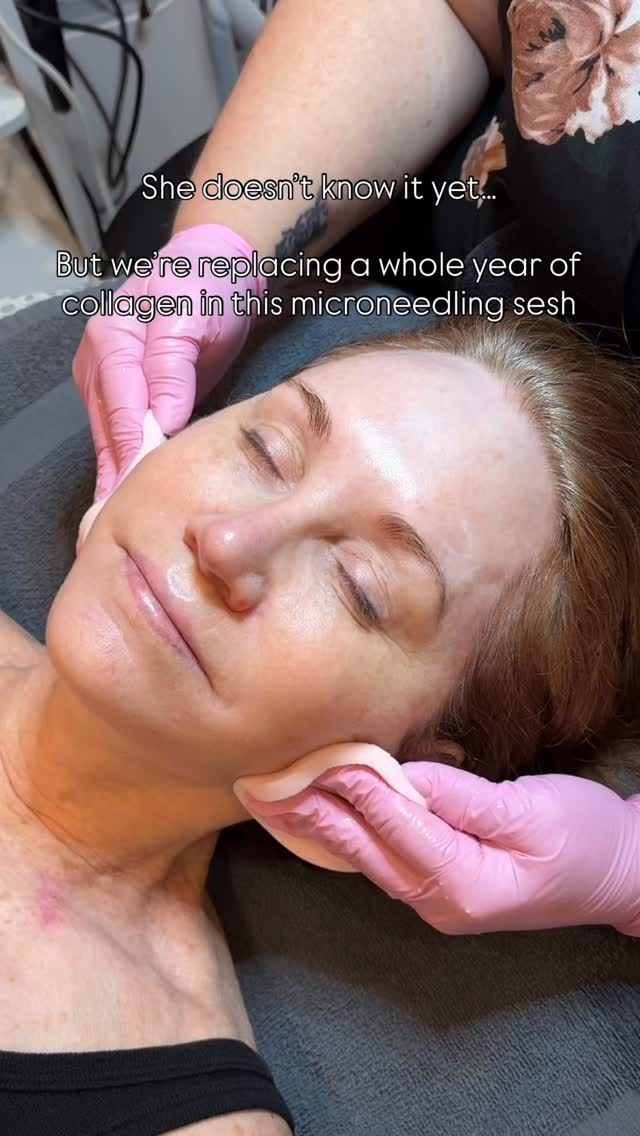 Microneedling helps restore & stimulate new collagen for firmer, smoother, even skin. Prevention is key to great skincare as we age - microneedling has your back! ✨
#microneedling #denvermedspa #esthetician #microneedlingfacial