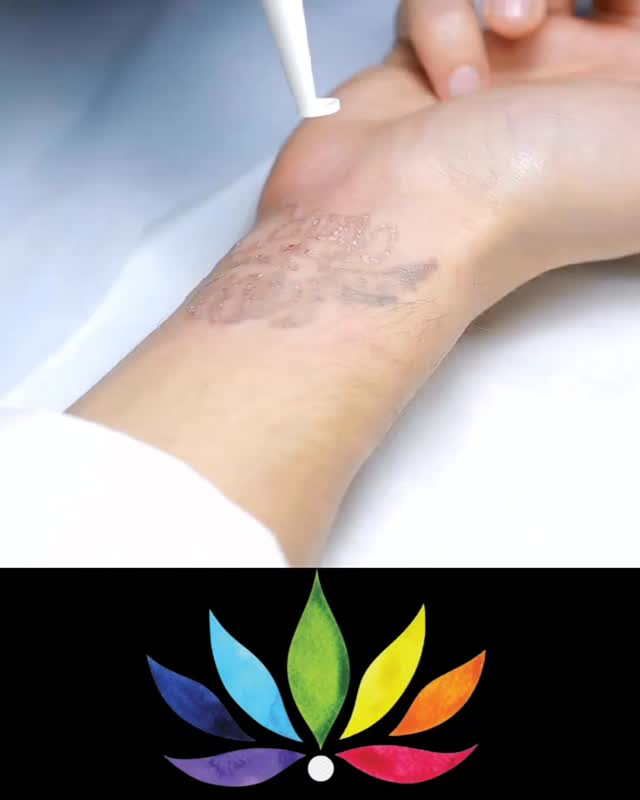 Say goodbye to ink you’ve outgrown ✨ Watch unwanted tattoos fade away session by session with our safe + effective removal treatments. Fresh skin, fresh start.
#tattooremoval #tattoos #lasertattooremoval #tattooregret #medspalife #tattoofree #glowup