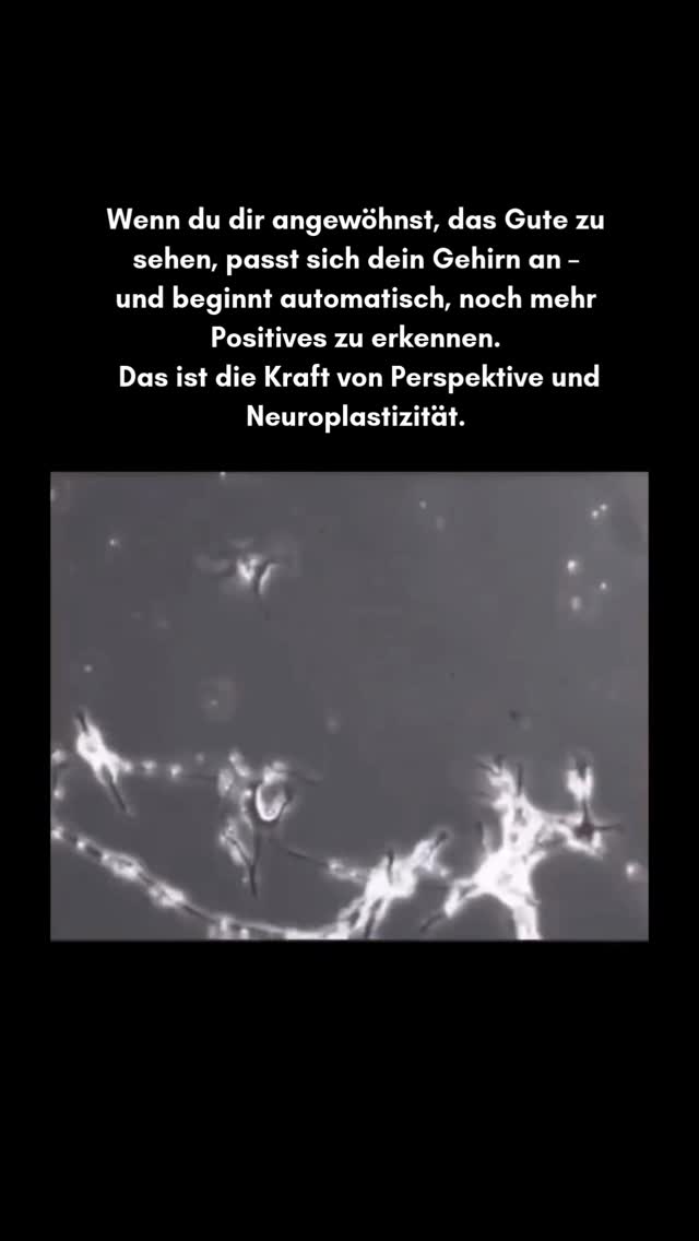 Dein Gehirn verändert sich jeden Tag – mehr als wir glauben ⤵️
1️⃣ Folge @mindyourchange_by_carmen
für ehrliche Impulse zu Perspektiven, Ruhe & innerer Balance.
2️⃣ Speichere diesen Beitrag,
wenn du deine Gedanken sanft neu ausrichten möchtest.
Die Art, wie du denkst, fühlst und reagierst,
ist nicht festgelegt.
Dein Gehirn verändert sich jeden Tag – und es passt sich an das an,
was du ihm immer wieder gibst.
Das nennt man Neuroplastizität.
Ein spannender Fakt dazu:
Der Psychologe Dr. Donald Hebb zeigte bereits 1949,
dass sich Verbindungen im Gehirn stärken,
wenn bestimmte Gedanken oder Gefühle regelmässig gemeinsam auftreten.
Sein berühmtester Satz:
👉 „Neuronen, die zusammen feuern, verbinden sich.“
Das bedeutet:
Wenn du kleine gute Momente bewusst wahrnimmst,
trainierst du dein Gehirn, sie leichter zu erkennen.
Ganz ohne Druck – einfach durch Wiederholung.
Mit der Zeit wird dein Inneres darin besser:
✨ Positives zu sehen
✨ Stress anders einzuordnen
✨ schneller Ruhe zu finden
✨ klarer zu entscheiden
4 einfache Wege, dein Gehirn sanft umzuprogrammieren:
1️⃣ Mini-Dankbarkeit
3 kleine Dinge pro Tag, die gut waren.
Dein Gehirn speichert das wirklich ab.
2️⃣ Den Moment länger halten
20–30 Sekunden bewusst in etwas Schönem bleiben.
So werden die Verbindungen stärker.
3️⃣ Perspektive finden
Bei Herausforderungen:
„Was ist ein kleiner Gedanke, der mir jetzt gut tut?“
Du lenkst deine inneren Bahnen neu.
4️⃣ Präsenz üben
Atmen. Fühlen. Kurz zurückkommen.
Viele gute Dinge sind da — sie brauchen nur deine Aufmerksamkeit.
Was du stärkst, wächst.
#coaching #mindset #gehirn #perspective #perspektive #positiv