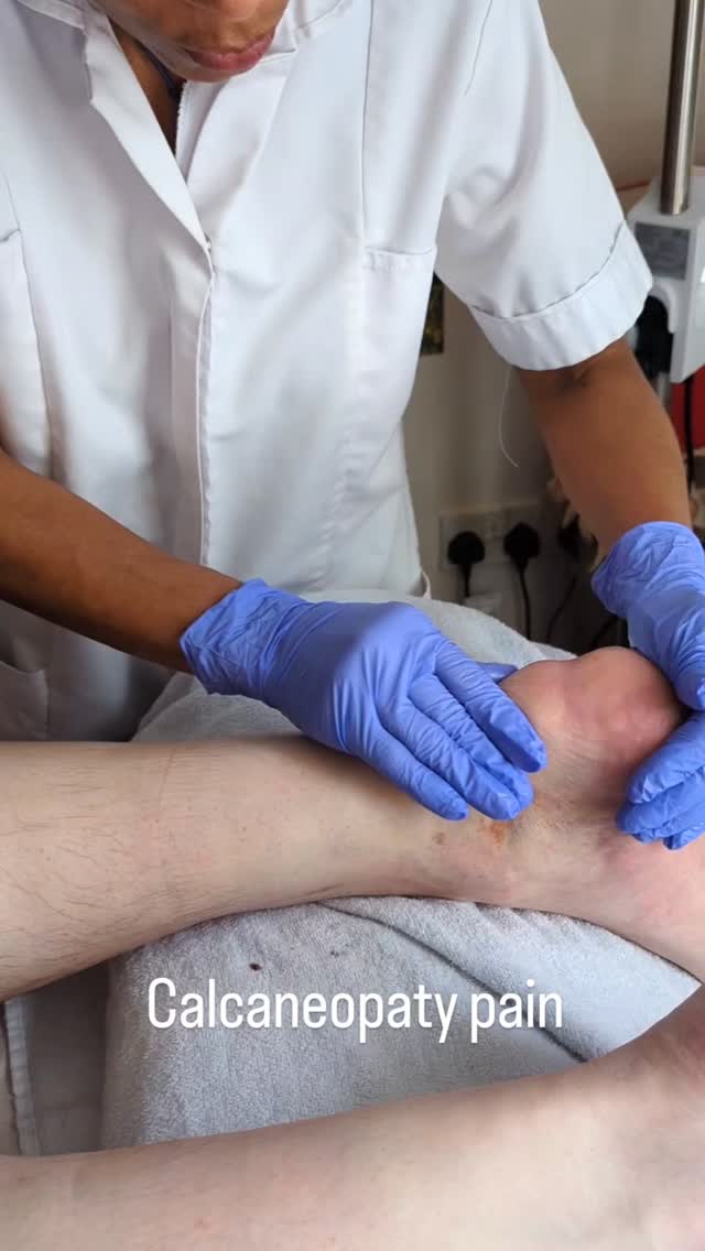 CALCAREOUS PATELLA PAIN . WHAT IS IT?
If you’ve ever felt a sharp, stubborn pain just below your kneecap that refuses to go away… it might not be “just tendonitis.
Sometimes, tiny calcium deposits build up inside the patellar tendon — this is called calcareous patella pain (or calcific patellar tendinopathy).
💥 Why it hurts:
Calcium deposits irritate the tendon, reducing mobility and making stairs, running, and even standing from a chair feel like a battle.
✨ Good news:
With the right combination of soft-tissue therapy, strengthening, and mobility work, most people can reduce pain and return to normal activity. Early treatment = faster recovery.
If knee pain has been slowing you down, you don’t have to live with it — your body is capable of healing with the proper guidance.
Book a session at Prodigious Hands and let’s get you moving again.
#kneehealth #calcareouspatella #patellapain #tendonpain #kneepainrelief #rehab #mobility #sportsmassage #prodigioushands #movementtherapy #healthyliving #painfreejourney
