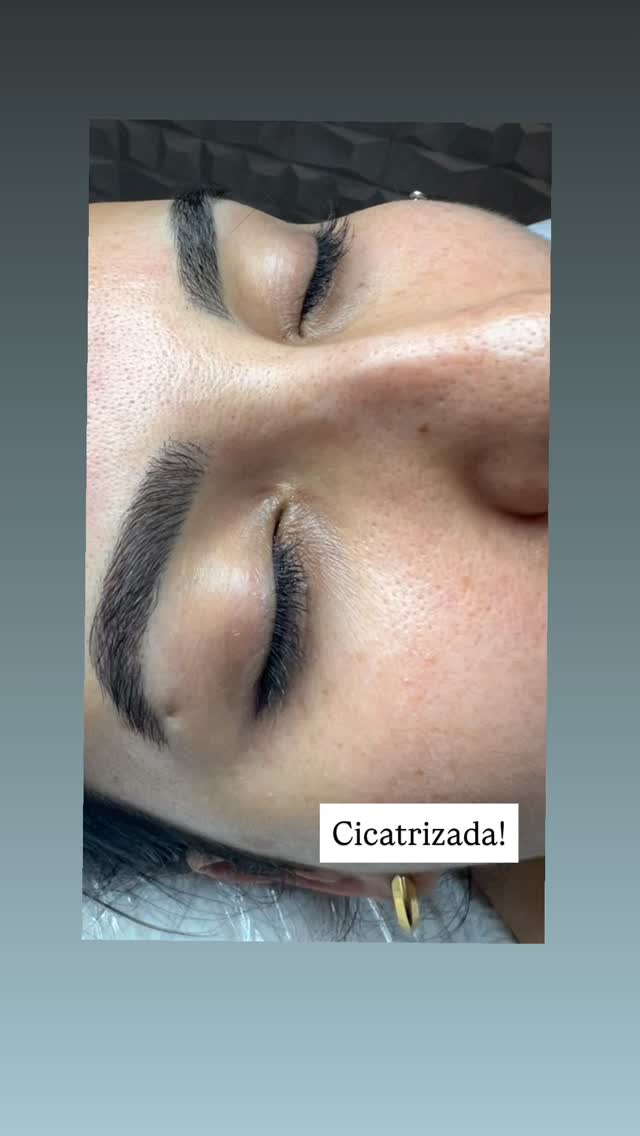 Volte no poste anterior pra ver esse mesma sobrancelha no dia que desenhamos essa Microblading.
Agora elas já estão cicatrizadas e maravilhosas 😍
Deixei sem filtros pra vocês acompanharem os detalhes !
Me chamem e agende !
O link está na Bio ♥️
🌐 www.lrmicroblading.com.br
📲 (34)99202-1600
#microbladingfioafio #lrmicrobladinguberlandia #micropigmentaçao #sobrancelhafioafio #belezaesaúde