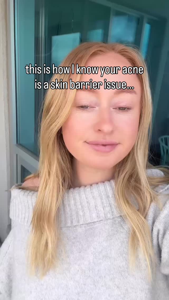 Here’s how I know when your acne is a barrier issue (or at least partially):
• Your skin feels tight after cleansing (even when you use a natural gentle cleanser)
• Moisturizer stings (again, even if it’s natural)
• Breakouts started after retinoids, acids, or benzoyl peroxide
• You have clusters of small red bumps (not deep cysts)
When your barrier is damaged, your skin loses water then inflammation increases then oil production compensates then pores clog then acne worsens.
And the worst part?
Most people respond by using more actives which is not the solution.
Teaching you exactly how to heal your skin barrier inside my program, The Acne Solution so you never have to experience this type of acne again! ♥️ link in bio!
Do you have a damaged skin barrier? What has / hasn’t worked for you?
#acneproneskin #skinbarrierrepair #skinbarrierhealth #acnefighter