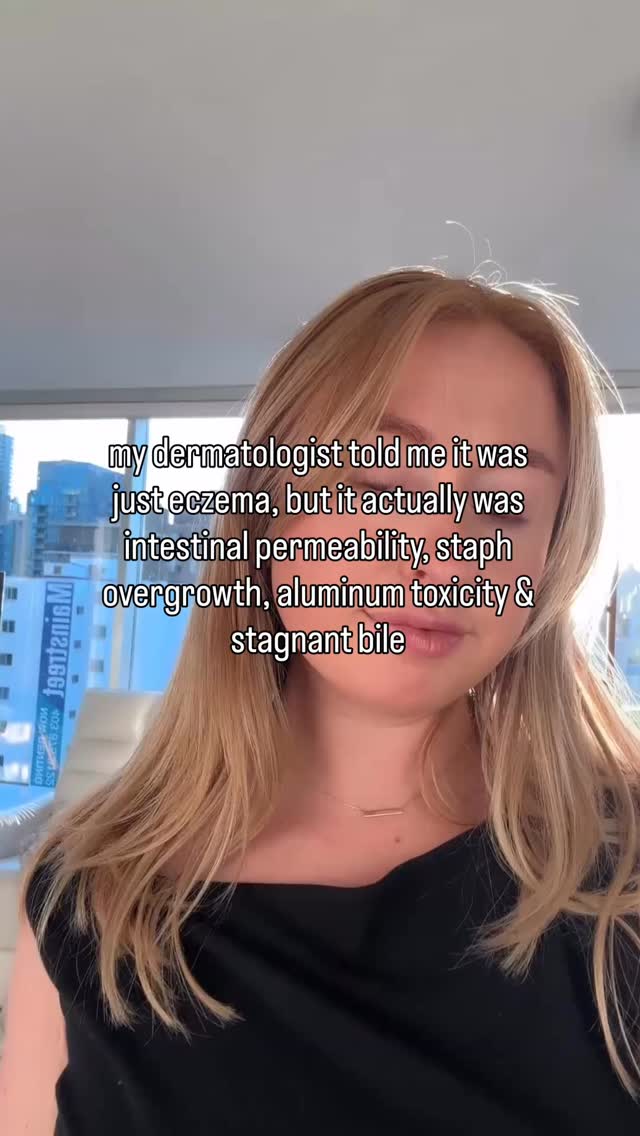 dermatologists will tell you it’s just eczema and hand you steroid cream 🫤
but let me tell you some deeper drivers that I often uncover in my eczema clients:
• Intestinal permeability
• Staph overgrowth
• Aluminum burden
• Sluggish bile flow
Let’s break this down 👇🏼
When the gut lining is compromised, bacterial fragments and inflammatory compounds can enter circulation and stimulate immune reactions in the skin.
Staph overgrowth (which is common in eczema-prone skin) doesn’t just sit on the surface. It can perpetuate inflammation, disrupt the skin barrier, and create a cycle of flare, irritation and more colonization.
Aluminum and other environmental burdens can add stress to detox pathways. When the liver and bile flow are sluggish, the body may struggle to efficiently clear hormones and inflammatory byproducts.
And bile matters more than people think. Bile isn’t just for digesting fats, it’s one of the primary ways we eliminate excess estrogen, toxins, and metabolic waste. When it’s stagnant, symptoms often show up in hormone-sensitive tissues… including the skin.
Your skin is communicating what your gut, liver, immune system, and microbiome are dealing with internally. Steroid cream doesn’t address any of this.
Comment ‘eczema’ and I will dm you a link to book a free call with me! Every single one of my clients have seen a 90% + improvement in their eczema from working with me and I’m very proud of that ♥️
#eczemahealing #eczemarelief #eczemafree #eczemacommunity #eczemawarrior