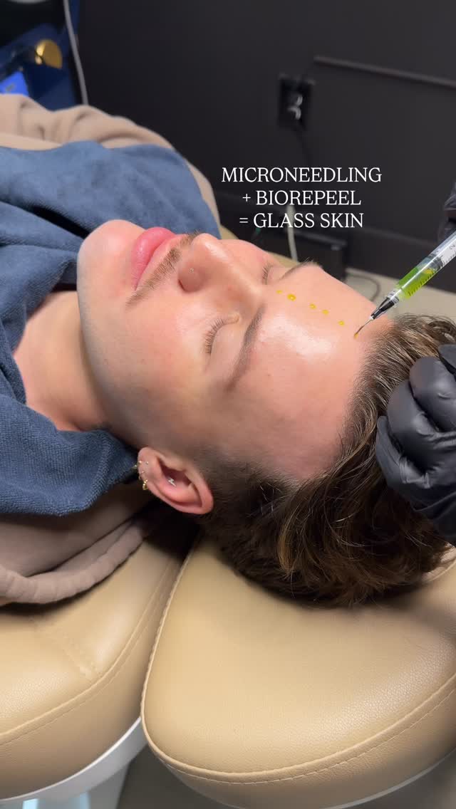 Microneedling works - When treatments are consistent, when proper depth is reached (not too shallow, not too deep), when good products are infused into the skin, when post care is being followed, when quality products are used afterwards.
“The 401K to our skin” 🤌🏻😮💨
