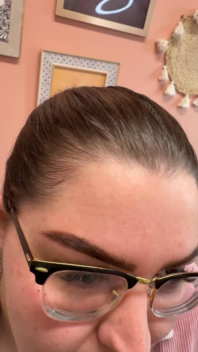 Once it’s cleaned…don’t touch it. Butttttttt if you do @a.dose.of.artistry will clean it again, and again, and again.
Want to keep that tox glow? Keep it clean, keep it sterilized… and most importantly…just don’t touch it!
#indy #indyinjector #injectables #indianapolis #aestheticnurse