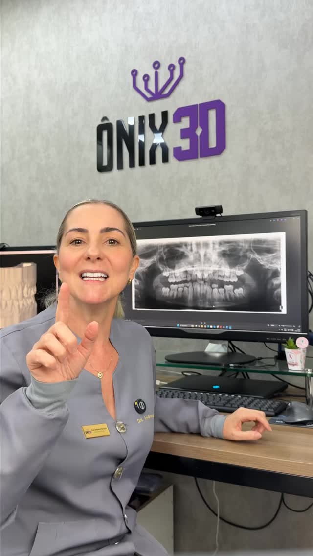Você sabia que a extração de um dente de leite pode evitar uma cirurgia complexa no futuro? 🦷✨
Muitas vezes, o caminho para um sorriso alinhado não começa com aparelhos fixos, mas sim com o diagnóstico precoce. No caso que mostro no vídeo, identificamos que os caninos permanentes estavam com uma rota de erupção desfavorável — o que chamamos de tendência à impacção.
🔵 O que a ciência diz? A literatura ortodôntica é sólida nesse sentido. O trabalho clássico de Ericson e Kurol (1988) demonstrou que a extração oportuna dos caninos decíduos (de leite) pode levar à autocorreção da posição dos caninos permanentes em cerca de 76% a 78% dos casos.
🟢 Evidências Atuais Estudos mais recentes e revisões sistemáticas (como Naoumova et al.) confirmam que essa intervenção interceptativa é extremamente eficaz. A chave do sucesso depende de dois fatores principais:
1. Momento exato: A intervenção deve ser feita enquanto o canino ainda tem potencial eruptivo.
2. Posição inicial: Quanto menos o canino tiver cruzado a linha média da raiz do incisivo lateral, maior a chance de sucesso.
🟠 Para os Pais Levar seu filho ao ortodontista por volta dos 7 ou 8 anos não significa que ele vai usar aparelho imediatamente. Significa monitorar o desenvolvimento para que intervenções simples, como a deste vídeo, evitem tratamentos longos, caros e cirurgias de tracionamento no futuro.
A ortodontia preventiva preserva a biologia e simplifica sorrisos! 🚀
Gostou dessa informação? Se você tem dúvidas sobre a troca de dentes do seu filho, deixe nos comentários ou envie para um pai ou mãe que precisa saber disso! 👇