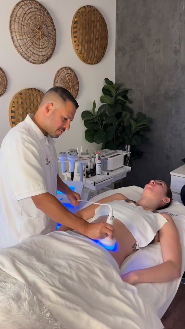 Body Contouring & Slimming Treatment
Say goodbye to stubborn fat and hello to a more sculpted body
Our body contouring treatment helps reduce fat, slim and shape areas like the stomach, love handles, thighs, and arms — with no surgery and no downtime.
✔ Fat reduction
✔ Body sculpting
✔ Skin tightening
Book your consultation today and start your transformation.
📍Idan Med Spa
📞 Call or DM to book
#bodycontouring #bodysculpting #fatreduction #slimmingtreatment #medspa encino losangelesmedspa noninvasivefatreduction
