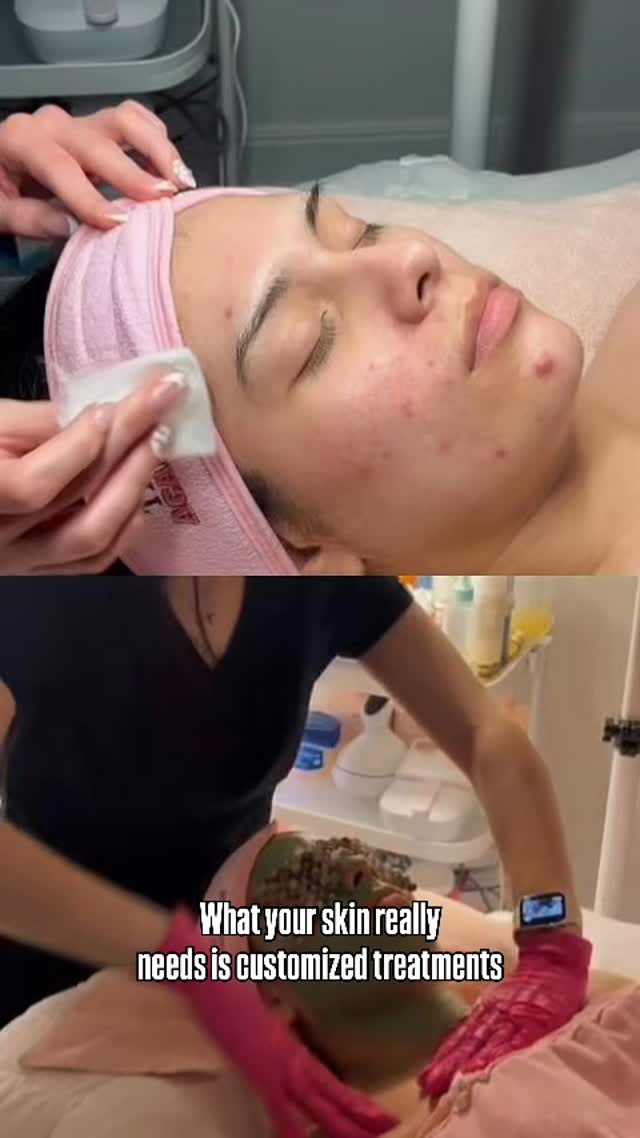 Your skin is constantly evolving… so why would your facial stay the same? ✨
With Simona, every treatment starts with reading the skin—not following a routine. This is what a true customized facial looks like 👇
🔍 Skin analysis first
We assess hydration levels, barrier health, congestion, pigmentation, and inflammation before anything touches your skin.
🎯 Targeted exfoliation
Whether your skin needs enzymatic, chemical (AHAs/BHAs), or gentle physical exfoliation—this step is selected based on your current skin condition, not your skin type label.
🧪Active ingredient infusion
From hydration boosters to brightening agents and barrier-repair serums, every product is chosen with intention to correct—not just maintain.
🔋Technique matters
Incorporating modalities like dermaplaning, extractions, lymphatic stimulation, or oxygen infusion to enhance results and support skin function.
💧 Barrier protection + repair
Because over-treating is just as harmful as under-treating—your skin leaves balanced, not stripped.
This is how you move from temporary glow… to real skin transformation 🤍
Because the truth is—your skin doesn’t need trends.
It needs the right protocol.
📍Trust Beauty Bar
#CustomizedFacial #SkinEducation #MedicalAesthetics #SkinBarrier #AdvancedSkincare