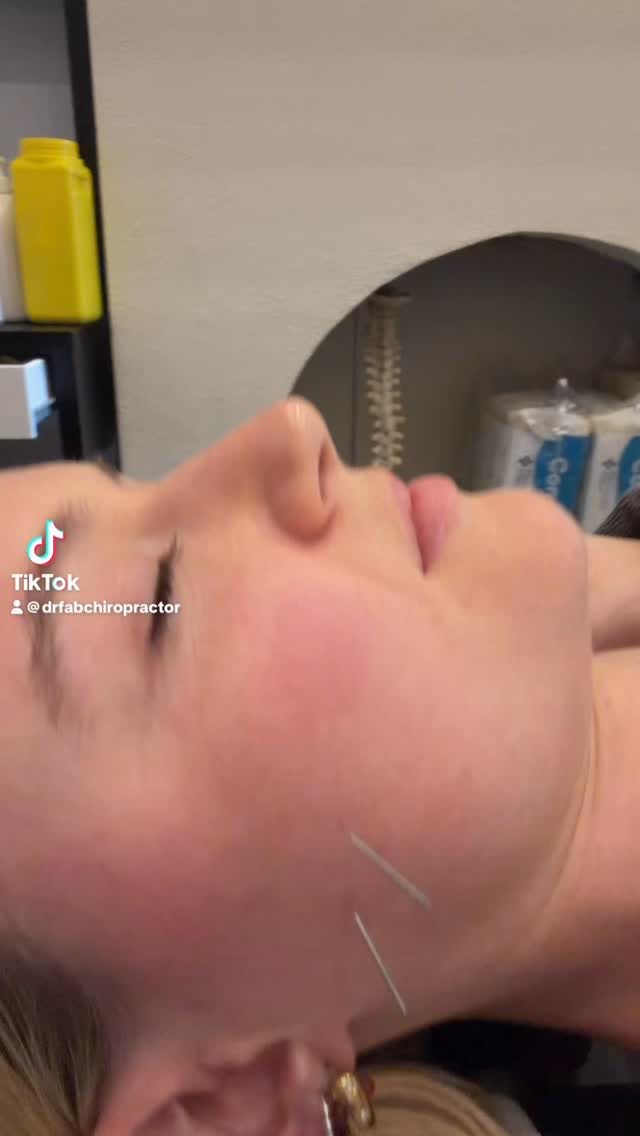 Is jaw pain (TMJ) keeping you up at night? 😣
You don’t have to live with the discomfort.
Targeted care like chiropractic dry needling, trigger point therapy, and lymphatic soft tissue work can help release tension, improve movement, and support natural healing.
✨ Imagine waking up without that tight, aching jaw
✨ Eating, talking, and sleeping with ease again
Ready to feel the difference?
Book your appointment today—we’re here to help you move better and feel better.
Disclaimer: Content shared is for informational purposes only and represents a brief snippet of a longer consultation. The treatments shown may not be suitable for your individual needs. Always consult with a licensed healthcare professional to determine what’s best for you. Individual results may vary.