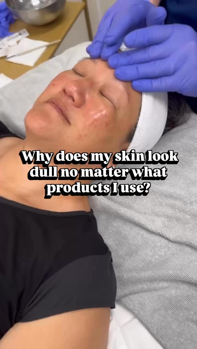 You can layer serums all day, but if your skin is dealing with:
– buildup
– slow cell turnover
– dehydration
– or a compromised barrier
…it literally can’t reflect light the way healthy skin does.
Translation? No glow.
This is where treatments come in.
Because real radiance isn’t from adding more—it’s from removing what’s in the way and correcting what’s underneath.
✨ Oxygenation
✨ Exfoliation
✨ Targeted correction
That’s how we get your glow back online.
Stop guessing. Start correcting. Let’s put you on a personalized plan so you’re ready for that big event this spring.