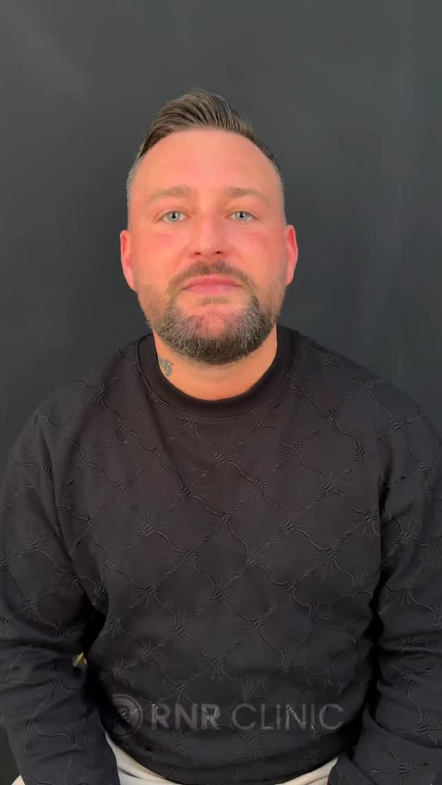✨ Modernes Design, sterile Umgebung und ein erfahrenes Ärzteteam für Ihr perfektes Lächeln.
🦷 In unserer komfortabel gestalteten Klinik planen wir Ihre Behandlung sicher und professionell mit unseren spezialisierten Zahnärzten.
🇩🇪 Besonders für unsere Patienten aus Deutschland bieten wir eine VIP-Betreuung und eine rundum organisierte Behandlung in Istanbul.
📩 Für ein kostenloses Beratungsgespräch und ein individuelles Angebot schreiben Sie uns gerne per DM.
#dentaltourism #zirkonkrone #implantat #zahnklinik #hollywoodsmile