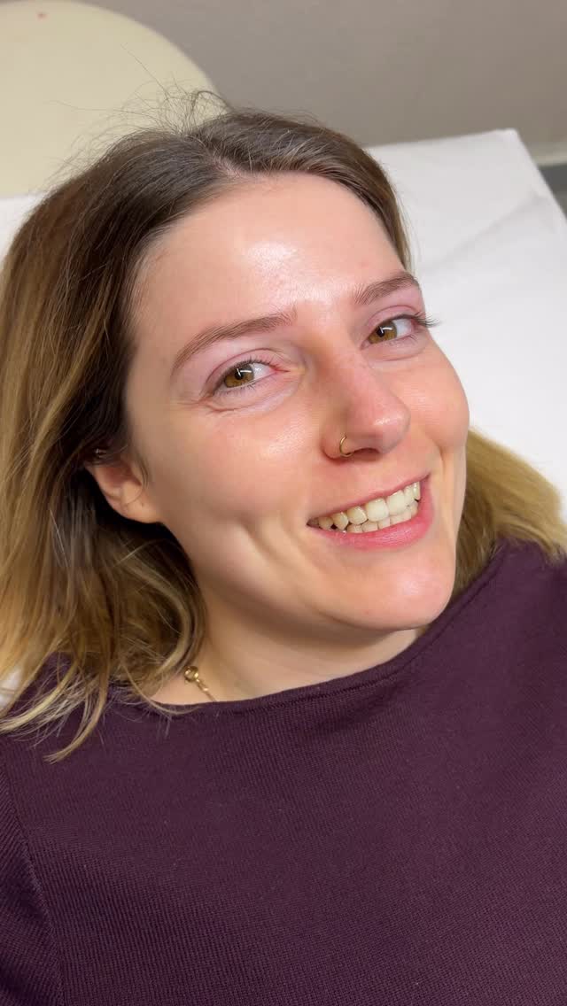 Manchmal braucht es gar nicht viel… ✨
nur die richtigen Details.
Ein Brow- & Lashlifting mit Farbe kann so viel verändern
ohne Make-up, ohne Aufwand, aber mit Wirkung.
Offene Augen, definierte Brauen und ein Blick, der direkt strahlt 🤍
Was viele nicht wissen:
Die Natürlichkeit liegt nicht nur im Produkt, sondern in der Technik.
Die richtige Form, die passende Farbe und das Gefühl dafür, wann es „genug“ ist – genau das macht den Unterschied.
Und genau darauf lege ich so viel Wert ✨
#beautyberchtesgadenerland
#piding
#badreichenhallbeauty
#salzburgbeauty
#salzburgkosmetik