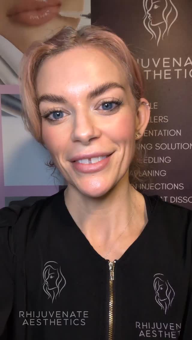 ✨ New Treatment Launch ✨
Introducing… Glow & Gossip 🥂
The perfect excuse to catch up with your bestie while getting that fresh, glowing skin.
👯♀️ Express Dermaplane Facial (30 mins each)
🥂 A glass of fizz included
💫 £35 per person when booked together
Because great skin is better with good company…
📆 Limited weekday slots available
📩 Message me “GOSSIP” to book
📱07903078274
📩admin@rhijuvenateaesthetics.co.uk
📍GU32 3EW
✨Complimentary consultations
💉 19 years medical background
#aestheticsinjector #aestheticshampshire #petersfield #offer #bestie