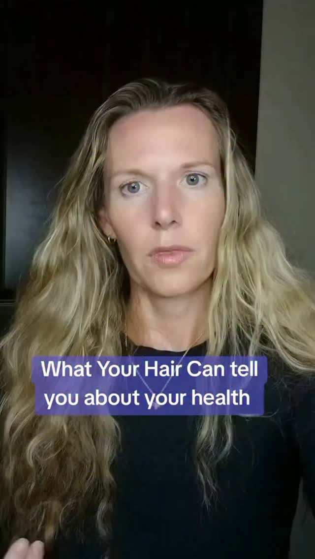 How your hair can give you insights to your health. Looking at the hair (as well as other symptoms) can give clues as to potential nutrient deficiencies in the body. First and foremost I am always checking thyroud function and iron levels in patients that complain of hair loss. Hair loss and thinning is a very common thyroid symptom but it is not the only reason for hair problems. #thyroidsymptoms #hypothyroidsymptoms #hairfall #hairloss #prematuregreying