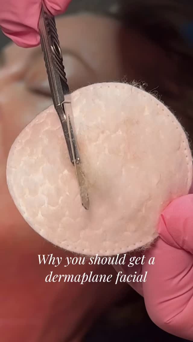 Don’t you love watching all that dead skin come off? So satisfying ✨
Our Dermaplane facial is the ultimate glow-up in one appointment. This gentle exfoliation removes dead skin & peach fuzz while also leaving your skin instantly smoother, brighter, and ready to absorb all the good skincare 💧
#esthetician #explore #denveresthetician #dermaplane #reels