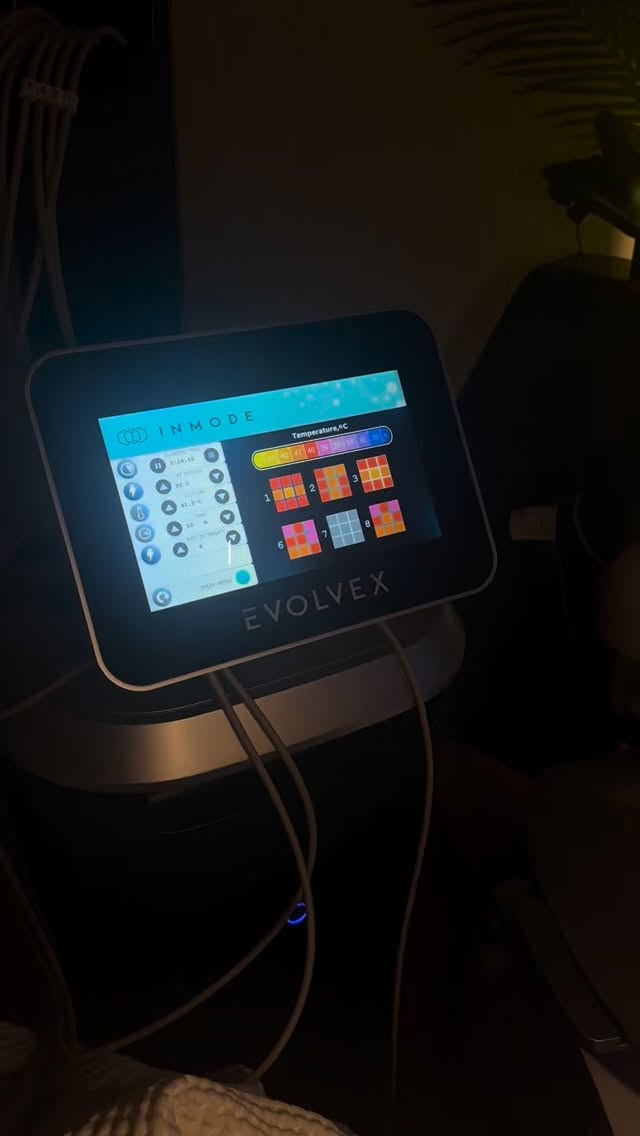 ✨ New Add-On Alert ✨
Add EvolveX to any treatment for just $350 (regularly $750).
Can be paired with facials, Morpheus8, microneedling, or PRX-T33—and performed while you’re numbing for convenience.
Treat abdomen, thighs, glutes, or arms to sculpt, tighten, and elevate your results in one seamless visit.
#evolvex #ocalamedspa #beyondskinandwellness