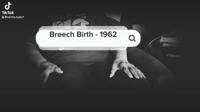 A breech birth story from 1962 - part 1. #blackmaternalhealth