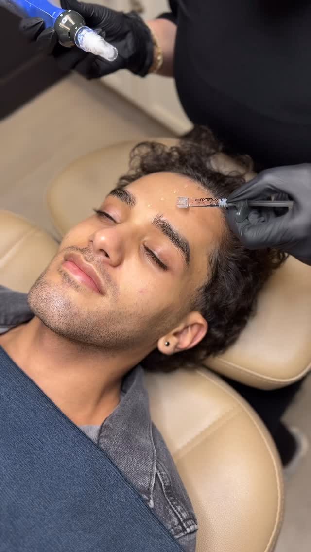 POV: your skin card doesn’t decline.
Invest in what matters most: YOURSELF.
#microneedling #salmonsperm #salmondna #skinpen®