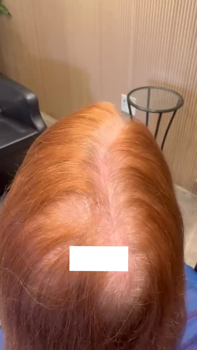 Red isn’t one shade.
It’s layers of tone, depth, and dimension.
And if it’s even slightly off… you can tell.
This is a fully custom topper designed to match her exact color so it blends seamlessly with her natural hair.
No guessing. No harsh lines.
Just hair that looks like hers again ❤️
#redhair #hairtopper #hairtoppersforthinninghair #customcolor