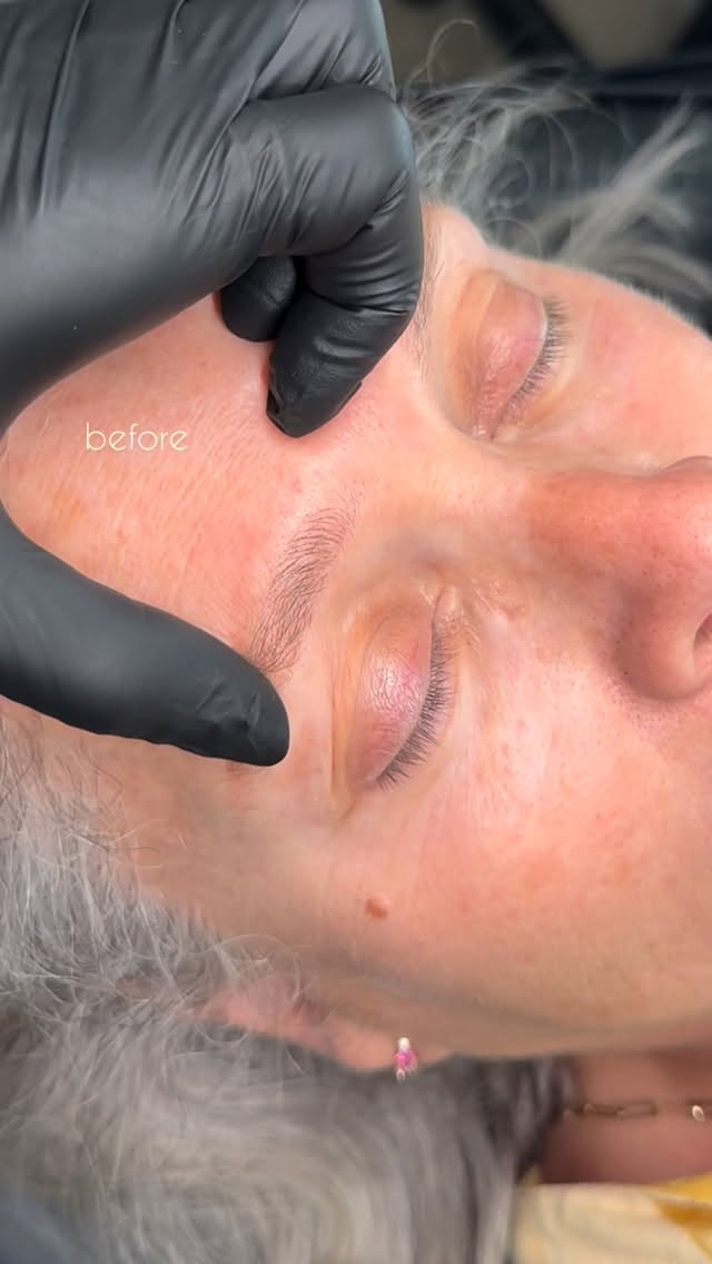 Subtle and beautiful hair strokes to enhance these gorgeous brows.
#machinehairstrokes #nanobrows #microblading #browtransformations #southfloridabrows #nanomachinehairstrokes