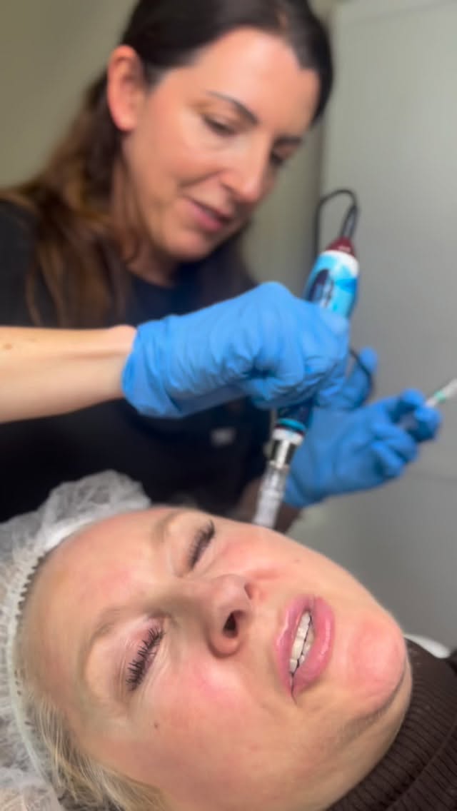 Your next step in aesthetics starts here ✨
Whether you’re a complete beginner or already working in the industry and ready to advance your skills, our bespoke training is designed around you.
From foundation aesthetics to advanced techniques, we offer fully accredited, hands-on training in a supportive and welcoming environment 🤍
✔ Beginner to advanced courses
✔ One-to-one personalised training
✔ Learn at your own pace
✔ Ongoing support & mentoring
✔ We can travel to your clinic for private training days
At @skiinpro, we focus on building confidence, safety, technique and real industry knowledge — helping you grow your skills and your business with expert guidance every step of the way ✨
Ready to invest in yourself and elevate your career?
DM us for course dates, private training enquiries or tailored training packages 📩
#aesthetictraining
#advancedaesthetics
#aestheticnurse
#beautyacademy
#aestheticpractitioner