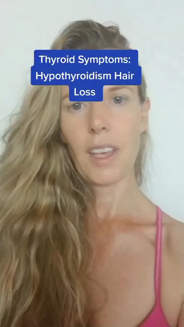 Hypothyroid Hair Loss: signs and symptoms and how to correct thyroid hair loss: optimize TSH, t4 thyroid hormone, address stomach acid and ensure collagen and protein in the diet. #thyroidsymptoms #hypothyroidism #hairloss #hair #thyroid