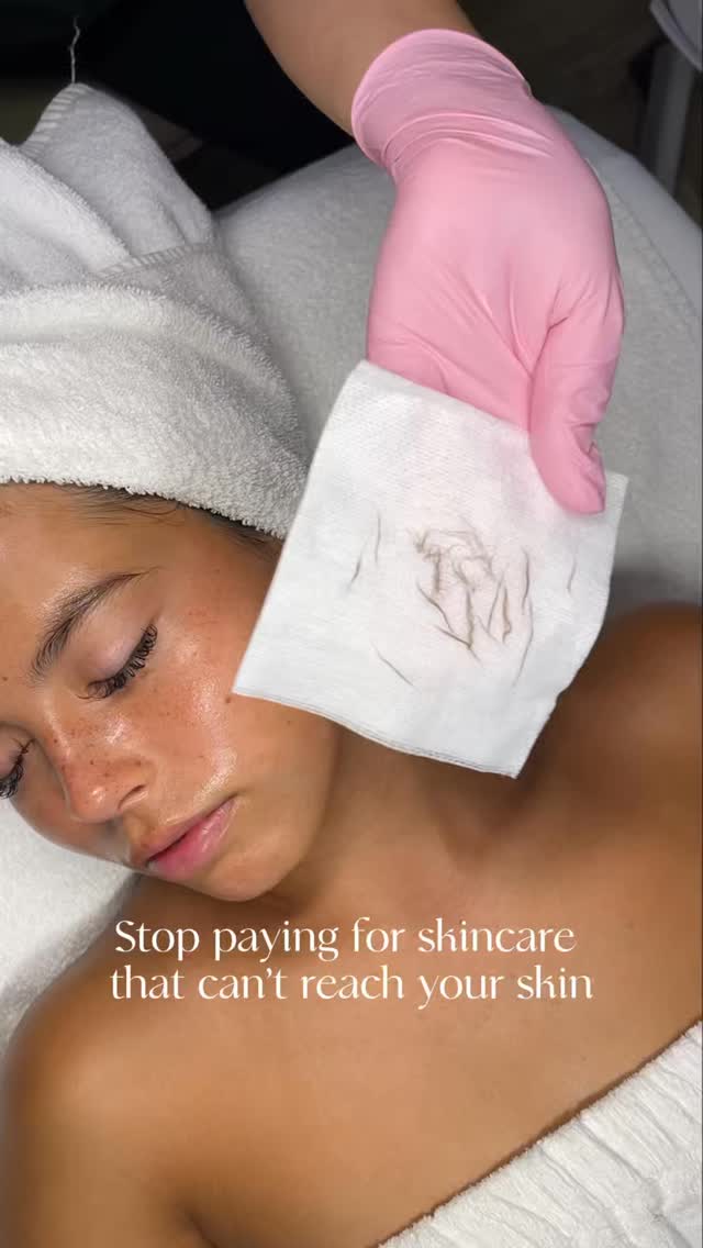 Your skincare isn’t the problem! The dead skin sitting on top of it is.
Dermaplaning removes the dead skin cells + peach fuzz sitting on top so everything — your serums, moisturizer, masks — can actually absorb the way they should. Smoother texture, better product results, and you’ll see the difference the second you walk out! Zero downtime. Instant glow.
If you want to take it up a notch book my personal favorite pre-event combo! Add a mini peel to your dermaplaning facial for the same zero downtime, but that extra pop of glow.
✨ New clients get 15% off their first facial all of June!
Click link in bio to book or text us: 808-594-6440