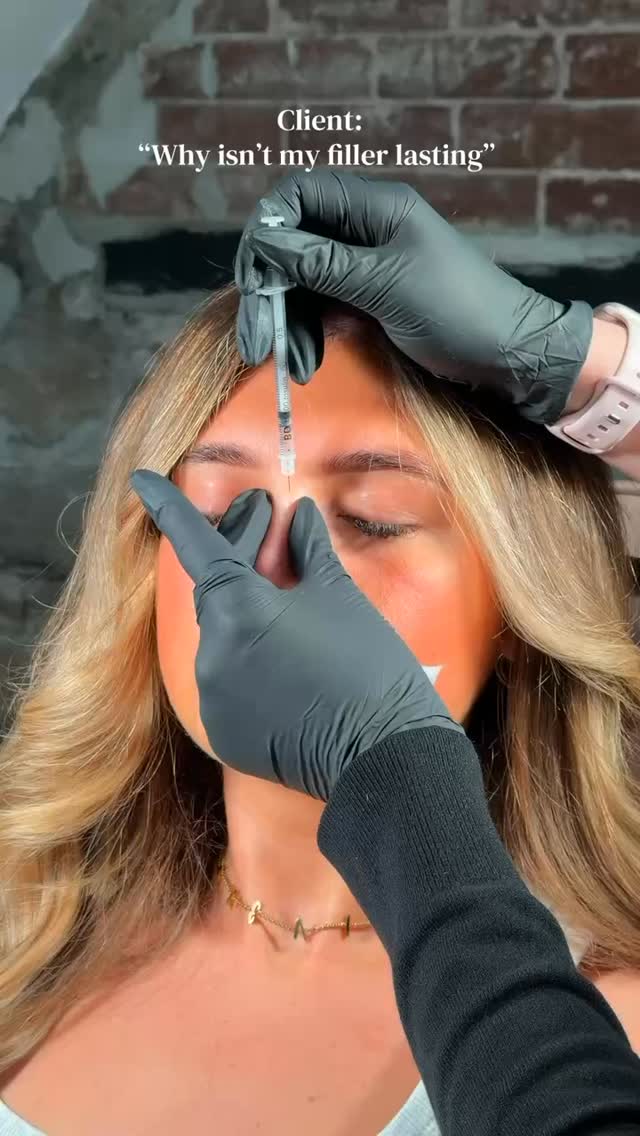 ⠀
POV: Your filler is trying its best…
Meanwhile:
☀️ Sunbeds
🚬 Smoking
💧 Not enough water
We all love a cheeky sunny B, but if you want to get the most out of your treatments, following your aftercare as best as possible is key. Your future self (and your filler) will thank you! 😂
__________________________
Get in touch 👇🏽
𝐃𝐌 𝐔𝐒 𝐅𝐎𝐑 𝐄𝐍𝐐𝐔𝐈𝐑𝐈𝐄𝐒
GIFT VOUCHERS AVAILABLE
SWIPE FOR CLINIC DATES
⭐️ 5 STAR GOOGLE REVIEWS
💻 www.archedaesthetics.co.uk
📱 𝗪𝐇𝐀𝐓𝐒𝐀𝐏𝐏 07517416782
📧 hello@archedaesthetics.co.uk
#lipfillerplymouth #dermalfillerplymouth #aestheticscallington #dermalfillercallington #aestheticsliskeard