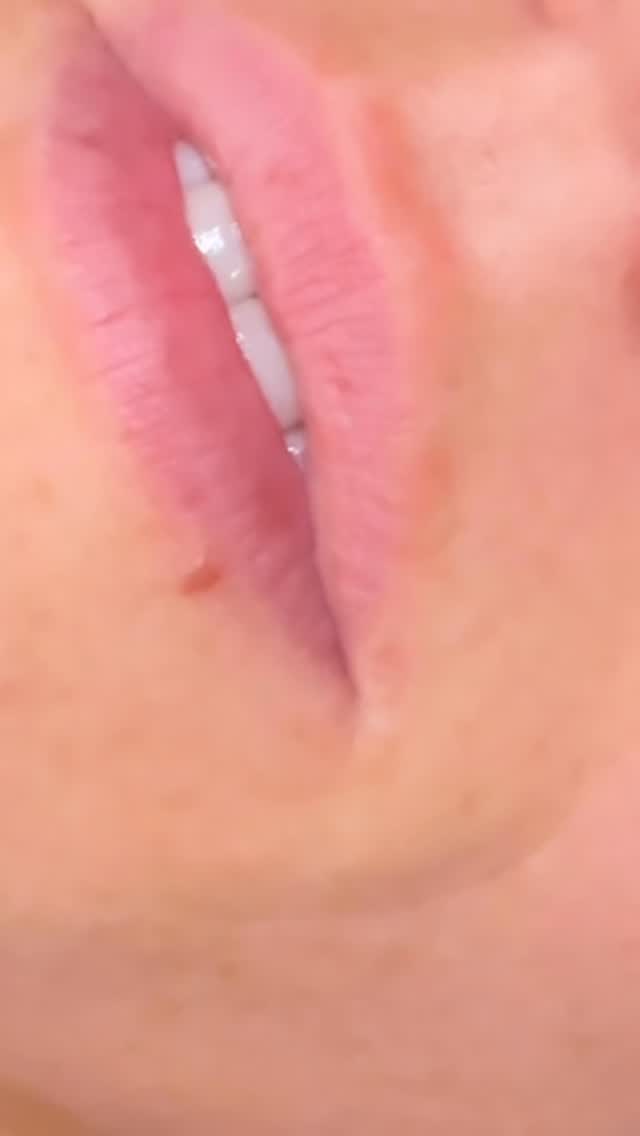 This soft lip blush was customized to enhance natural beauty with subtle definition and a fresh, youthful flush of color. The goal isn’t to change your lips—it’s to bring back what time may have softened.
Every lip blush treatment is fully customized to your features, skin tone, and desired result, whether you prefer a barely-there tint or a little more definition.
#greenwichct #lipblush #naturalbeauty