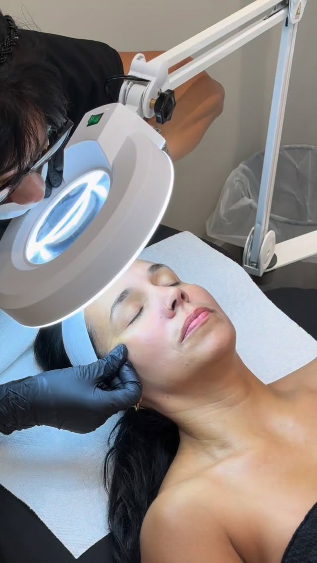 Self-care starts with healthy, glowing skin. ✨
💚 Our in-house esthetician, Vivian, is treating this patient to our Deluxe Facial - a rejuvenating treatment designed to deeply hydrate, gently steam, exfoliate, and perform extractions for a refreshed, radiant complexion.
📲 (305) 661-1996
🛍️ Shops at Merrick Park
📌 Soler-Baillo Plastic Surgery
#DeluxeFacial #HeathySkin #GlowingSkin #FacialTreatmentMiami #SkinRejuvenationMiami