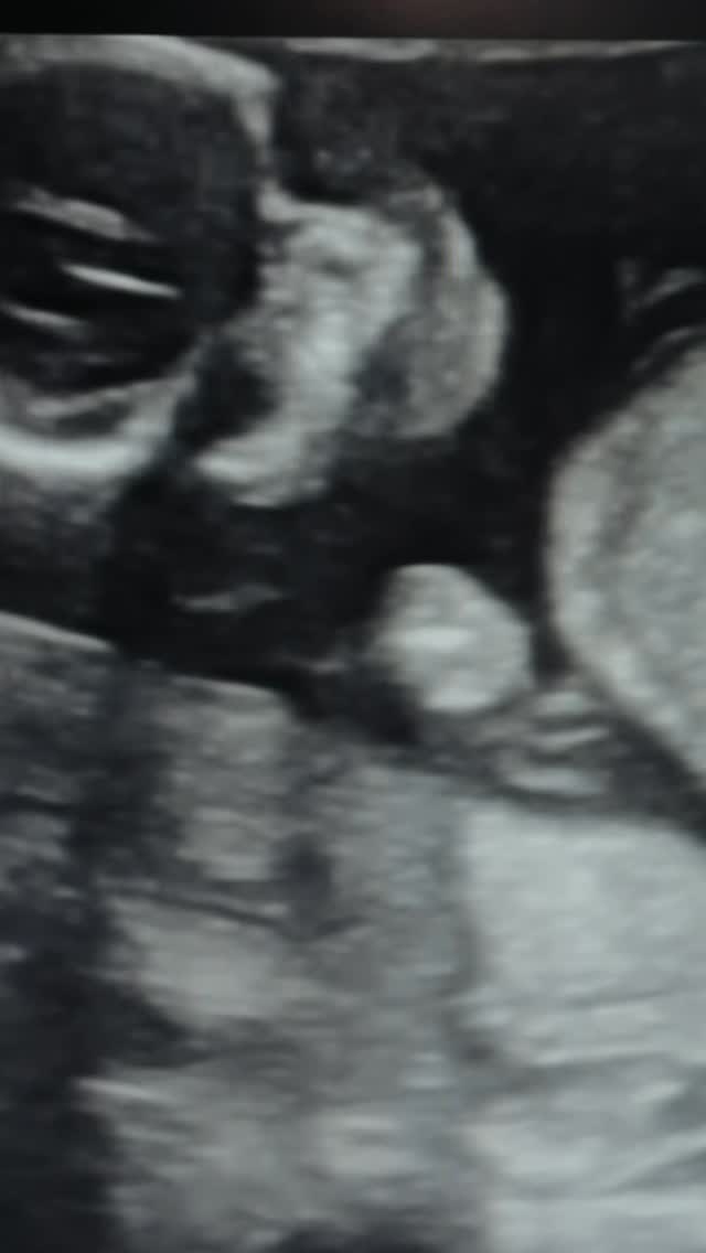 The long awaited reveal!