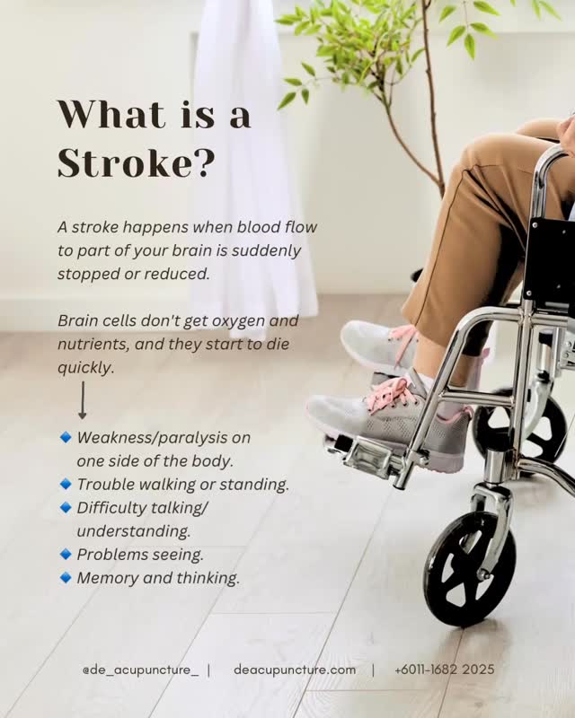 🚨 What is a Stroke? A brain emergency! 🧠💥
A Stroke, or a “brain attack,” happens when blood flow to your brain is blocked or a blood vessel bursts, starving brain cells of oxygen. This is a medical emergency where every second counts! ⏰
In TCM, Stroke is called “Zhong Feng” (中风), literally meaning “Wind Attack.”
TCM views the root causes not just as Western blockages, but as internal imbalances that lead to the attack:
🔺Internal Wind (内风):
Often generated by a chronic imbalance in the Liver (like uncontrolled high blood pressure or stress/anger). This Wind is what causes the sudden, one-sided symptoms like paralysis.
🔺Fire (火) & Deficiency (虚):
Long-term stress, poor diet, or overwork can create Heat/Fire (damaging your vessels) and deplete your Yin (the body’s cooling, nourishing reserve), making you vulnerable.
🔺Phlegm (痰) & Blood Stasis (瘀):
Sticky Phlegm and stagnant Blood are the physical ‘blockages’ that clog your channels, leading to a Stroke.
⚠️ WARNING: If you or a loved one shows F.A.S.T. signs, call for emergency medical help IMMEDIATELY. TCM is a complementary treatment, not a substitute for acute Western medical care in a Stroke emergency!
Ready to proactively manage your risk factors like high blood pressure and stress? Consult our qualified TCM practitioners at 医心医意中医坊 De Acupuncture x Herbs Centre!
We’ll assess your unique body pattern and tailor a plan for prevention and, if needed, rehabilitation.
Click the link in our bio to book your wellness consultation today! 💖
#StrokeAwareness #FAST #TCM #Acupuncture #医心医意中医坊