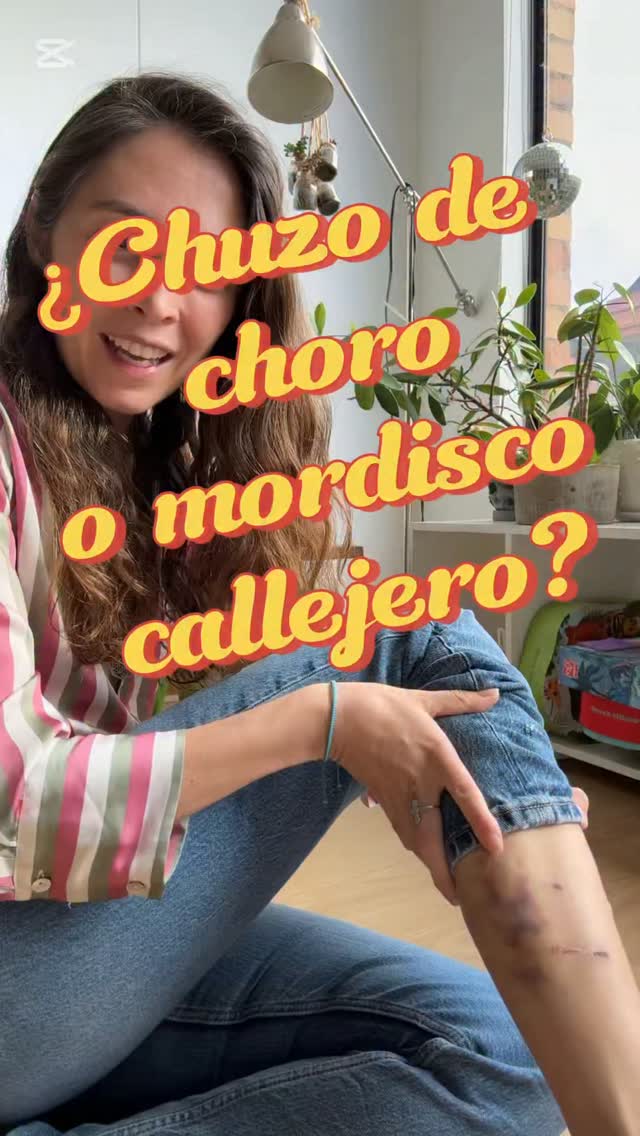 ¿Qué escogen? ¿Enfrentarse con choros en un puente peatonal o sufrir el mordisco de un perro callejero? Me estaba preparando para visitar un cultivo de Flores, pero la noche antes tuve que decidir entre esas dos perlas…
No les voy a enseñar nada agropecuario en este video. Esta es una reflexión sobre lo absurdo de una sociedad llena de discursos sobre la “protección de derechos” en la que cuando hay que actuar para evitar una tragedia nos quedamos en el papel, como si los ideales nos pudieran salvar.
Los derechos, las declaraciones, los ideales sirven para caminar hacia un futuro mejor, pero no pueden convertirse en obstáculos para resolver los problemas urgentes del presente. @carlosfernandogalan @alcaldiadeusaquen