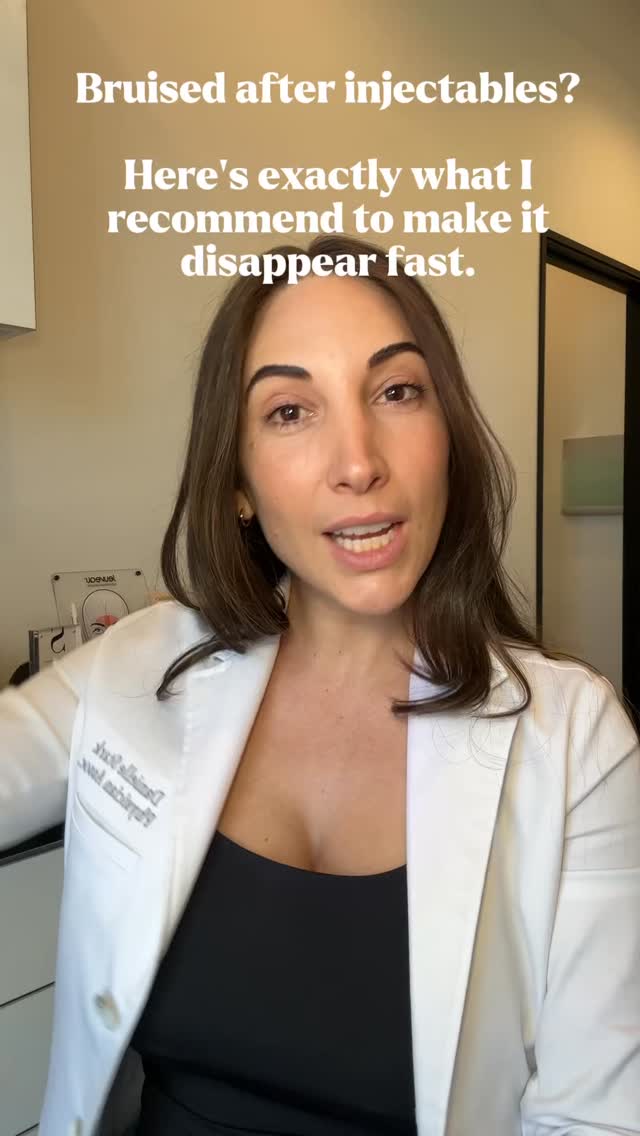 Bruised after your treatment? Here’s the timeline and products that actually work ⬇
🧊 First 24-48 hrs: Ice, ice, ice. This constricts vessels and slows bruising before it sets in.
🔥 After 48 hrs: Switch to heat if there is dark bruising. It boosts circulation and helps your body clear the bruise faster.
💊 Every day: Arnica + Vitamin K topicals are your MVPs — apply consistently to speed up healing and fade discoloration.
Bruising happens to the best of us (yes, even with the gentlest hands 🙋♀️). It’s not about avoiding it completely — it’s about knowing how to treat it right.
Save this for your next appointment 📌
