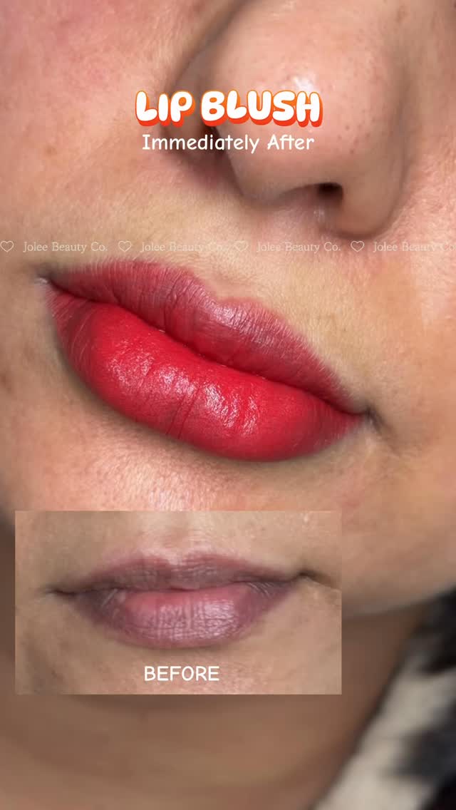 Fresh today, soft & natural once healed 👄✨
One of the biggest things to know before getting Lip Blush — don’t judge your colour on day one!
Immediately after your appointment, your lips will look brighter and more vibrant. As they heal, the colour gradually softens, leaving a beautiful subtle tint that enhances your natural lips. 🤍
Perfect for anyone wanting:
✨ More even-looking lip colour
✨ Beautifully defined lips
✨ A soft, natural tint
✨ Less reliance on everyday lip colour
📍 Lip Blush appointments available in Prestons, South-West Sydney
Ready for your lip transformation? Send us a DM or book your appointment online. 🤍
#LipBlushSydney #LipBlushPrestons #CosmeticTattooSydney #LiverpoolNSW #southwestsydney