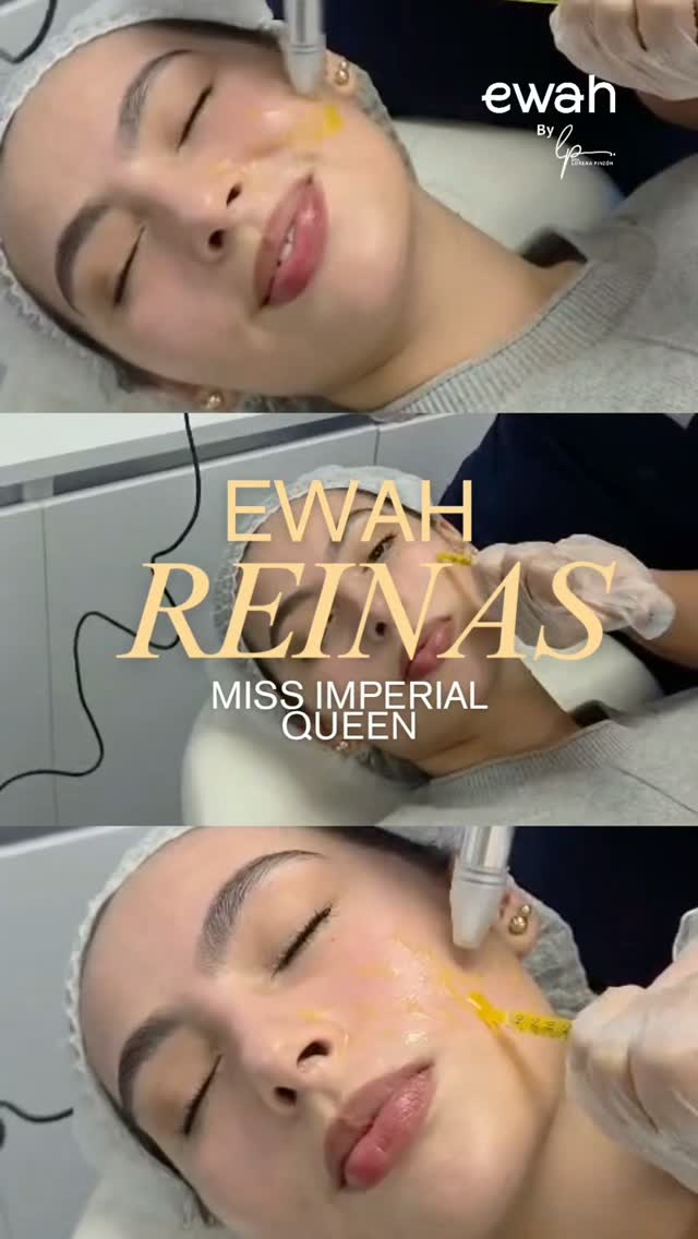 👑✨ Gracias, Laura Melo(@laurasofiamelo_ ), por confiar en nosotras.
Como Miss Imperial Queen, Laura representará a Colombia en el Miss Globe International 🇨🇴🌏 en Tailandia — y para lucir una piel joven, luminosa y sana en cada escenario, confía en EWAH By Dra. Lorena Pinzón.
Su secreto: microagujas de titanio Nanopore + nutrición profunda — el tratamiento preventivo antiedad que estimula colágeno, mejora la textura y le da a la piel ese brillo natural que ningún filtro logra copiar. ✨
Brillando desde adentro, con las joyas de @byvizcarra completando el look. 💎
¿Y tú? No esperes a los 40 para cuidar tu piel — el mejor momento para empezar tu protocolo preventivo antiedad es siempre ahora. Agenda tu valoración en EWAH. 👇
📍 3 sedes en Bogotá 📲 WhatsApp: +57 312 305 3887
#LauraMelo #MissImperialQueen #MissGlobeInternational #Nanopore #MedicinaEstéticaBogotá PrevenciónAntiedad ByVizcarra ColombiaEnTailandia PielSana DraLorenaPinzón