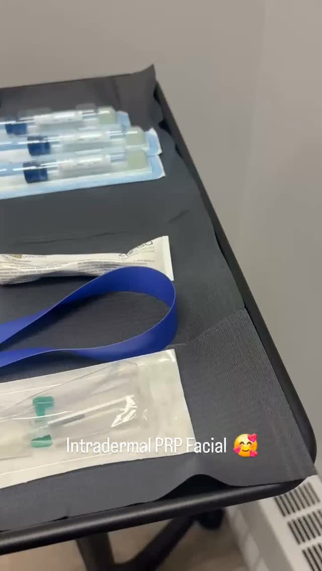 A closer look at a PRP facial 💉✨
Here I’m using an intradermal droplet technique—placing small amounts of platelet-rich plasma (PRP) directly into the skin with a fine needle.
PRP is prepared from a sample of the patient’s own blood, processed to concentrate the platelets. These platelets release growth factors involved in tissue repair and communication between cells, including the fibroblasts that produce collagen.
The treatment aims to support gradual improvements in skin quality, including texture and the appearance of fine lines. Small, temporary bumps can form where the droplets are placed. Redness and swelling is also common as the skin settles.
Thoughtful assessment, appropriate technique and realistic expectations are all part of the process. 💙
Posted with the patient’s consent for sharing on social media.
Tyler Hand, Nurse Practitioner | Beauty Xpressions
#prpfacial #plateletrichplasma #skinquality #beautyxpressions