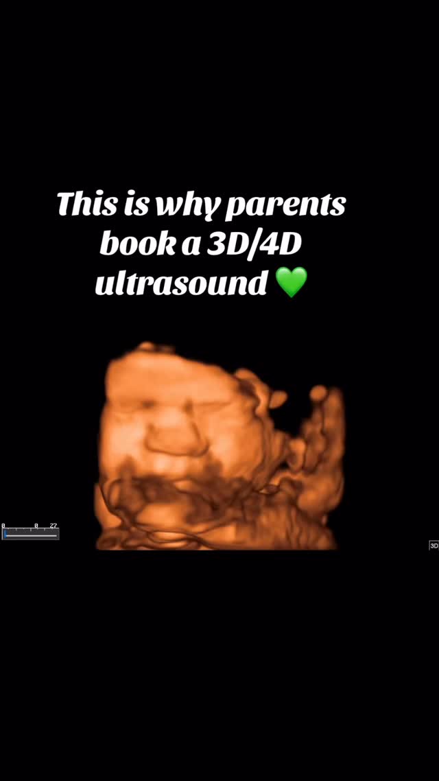 Before you hold your little one in your arms, you can catch a glimpse of the little face you’ve been dreaming about.
A 3D/4D ultrasound lets you see those tiny facial features, sweet smiles, little stretches, and precious movements.
Capture the magic of your pregnancy and treasure a glimpse of your little one before you finally meet.
#sweetpeafamily #3d4dultrasound #ultrasoundstudio