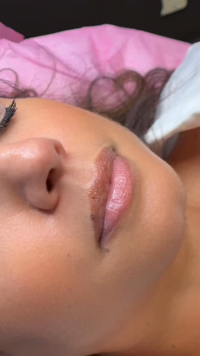 **AUDIO ON**
Lip neutralization is a process, not a one-and-done service 💋✨
This is her second session, and after just one pass you can already see the warmth coming through and the difference between the top + bottom lip.
With darker pigmentation, we work with the lips, not against them—building the color gradually for the best healed result. 🤎
Trust the process. Healed results are always the goal. ✨
#permanentmakeup #powderbrows #pmuartist #beauty #lipblush