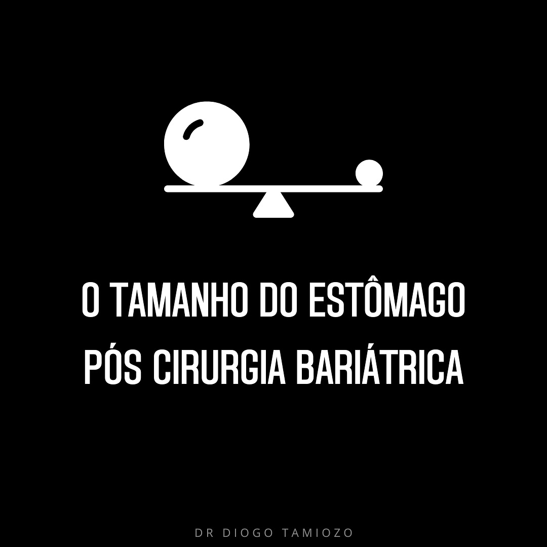 Uma dúvida frequente no consultório é sobre o tamanho do estômago após a cirurgia bariátrica: ele cresce? Ele permanece do mesmo tamanho? Isso é errado?
Então, pessoal, uma coisa que é preciso ter em mente é que o tratamento da obesidade é crônico. A cirurgia é apenas um trampolim, um passo para você mudar de vida e se adaptar à nova realidade. Como será essa nova vida? Com mudança de hábitos, exercício físico e adaptação ao novo corpo. Isso será o seu combustível.
Se o estômago crescer um pouco, o que é fisiológico, ele está se adaptando. Ele deve crescer, vai se adaptar ao seu novo corpo, ao seu novo organismo, e isso vai proporcionar qualidade de vida no futuro. Você vai conseguir comer um pouco mais do que nos primeiros meses após a cirurgia. Isso é completamente fisiológico, normal e muito saudável.
O problema está nos hábitos. Vamos fazer a cirurgia, mas precisamos mudar os hábitos.
