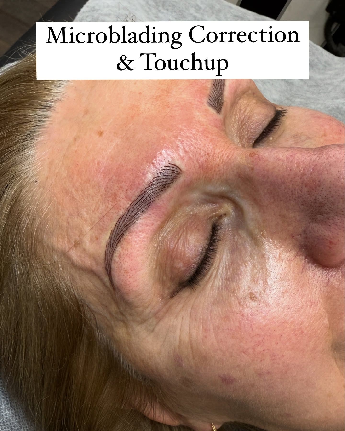 🌟✨ Ready to transform your look? Book your appointment today! 💖🌟✨
Microblading is the ultimate game-changer for achieving natural-looking, perfectly shaped eyebrows. Whether you want to enhance your existing brows or create a whole new look, our skilled artists are here to help you achieve your brow goals!
#Microblading #BrowGoals #Beauty #EyebrowsOnFleek #microbladingvaughan #microbladingtoronto #beautyvaughan #skincarevaughan #aerolasevaughan #injectablesvaughan #tattooremoval
Feel free to book a FREE consultation. Click the link in our bio or call 905-850-5899